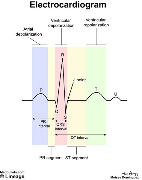 Electrocardiogram (ECG) - Cardiovascular - Medbullets Step 1