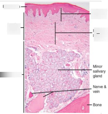 Histology of the Oral Mucosa Diagram | Quizlet