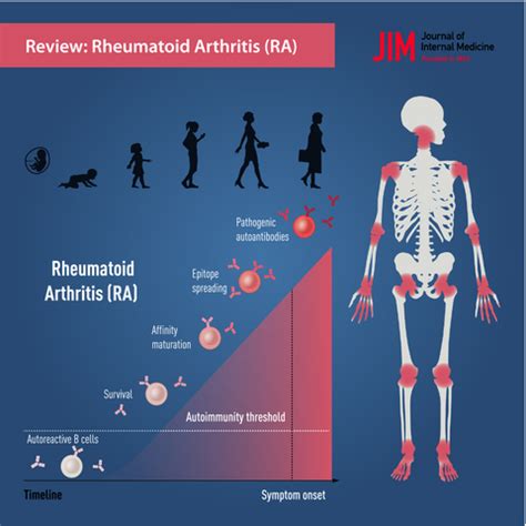 Individuals at risk of seropositive rheumatoid arthritis: the evolving ...