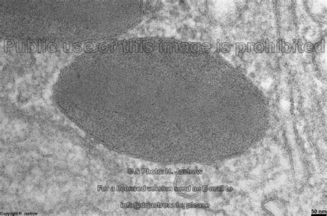 Lysosomes Dr.Jastrow's electron microscopic atlas