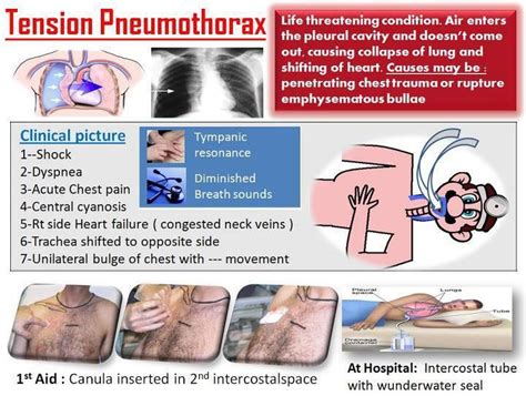 Pin on Medicine - Helpful Medical Diagrams