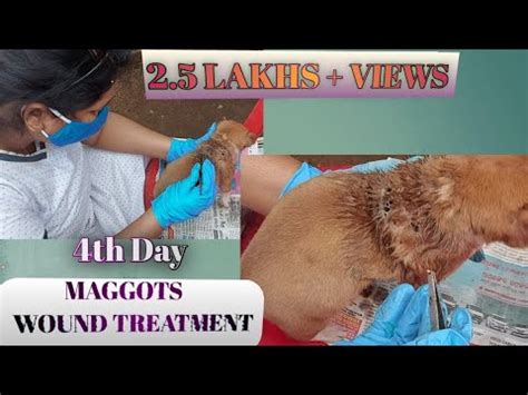 Maggots Treatment|| 4th Day of Maggots wound Healing Treatment - YouTube