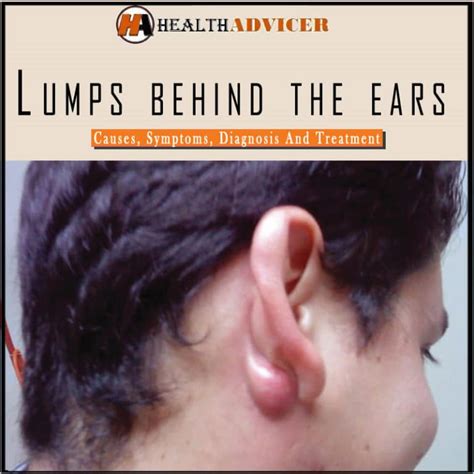 Lump Behind Ear Lobe No Pain at Thomas Joseph blog