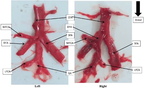 Arteries on both sides of a subject: to the left, the CFA ended by... | Download Scientific Diagram