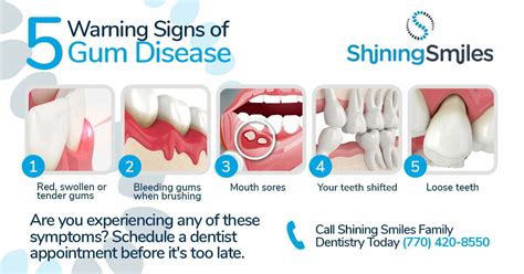 Gum Disease Treatment: Our Marietta Dentist Explains | Shining Smiles Family Dentistry