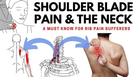 Shoulder Blade Pain Relief From Fixing The Neck - YouTube