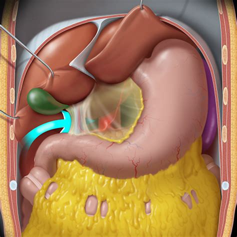 Greater and Lesser Omentum, Graphic [1 of 6]