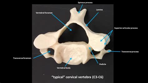 Vertebrae Cervical : Regional Characteristics of Vertebrae - Unity Companies - These vertebrae ...