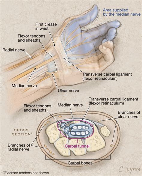 Median Nerve Carpal Tunnel