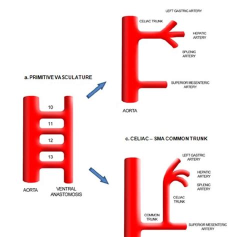 Embryology of normal vascular anatomy and variant celiac-SMA trunk. In... | Download Scientific ...