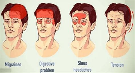 How to Get Rid of Sinus Headaches Very Quickly 2018