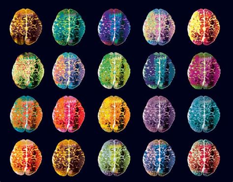 What Does a Smart Brain Look Like? - Scientific American