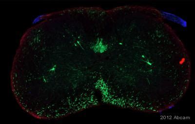 Anti-Myelin Protein Zero antibody (ab39375) | Abcam