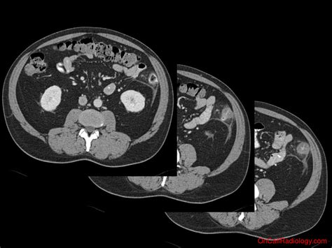 On Call Radiology - common radiology findings on call and in the Emergency Room and during the ...