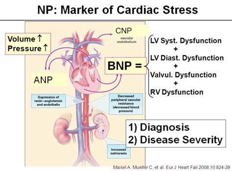 BNP elevated – what now!?? – Critical Care Northampton