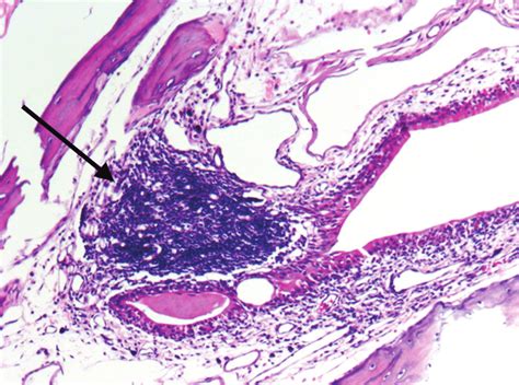 Histologic changes in the inferior turbinate after daily exposure to... | Download Scientific ...