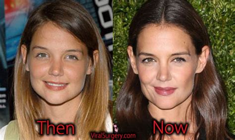 Katie Holmes Plastic Surgery: Before After Nose Job Pictures