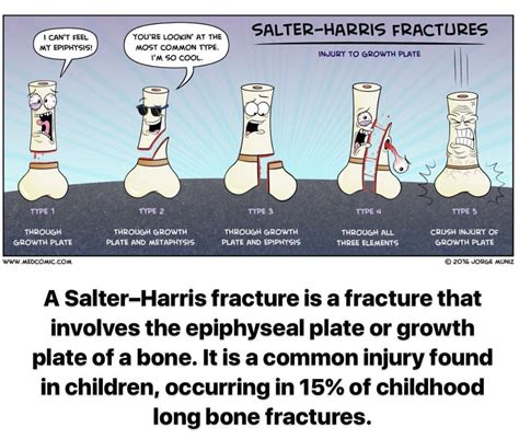 Salter Harris Fractures | Orthopedic surgery, School help, Nurse life