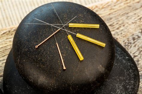 Acupuncture needles Stock Photo by ©ginasanders 58527273