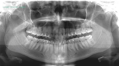 3D Dental Scan: Cost, Procedure, and Why You Need It