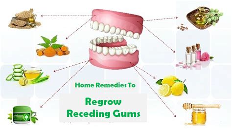 Natural Remedies For Receding Gums - change comin
