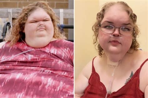 See 1000-lb Sisters star Tammy Slaton's body transformation as she sheds the pounds in rehab ...