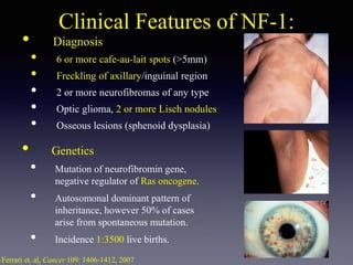 Peripheral Nerve Sheath Tumors | PPT