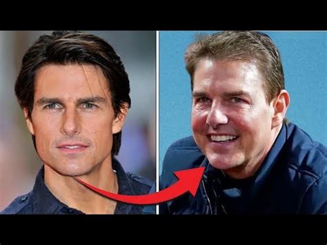 Top 37 Tom Cruise Nose Job Update