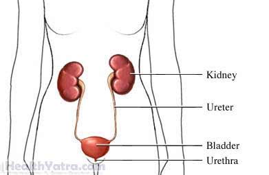 Acute Cystitis Definition, Causes, Symptoms, Complications and Cost ...