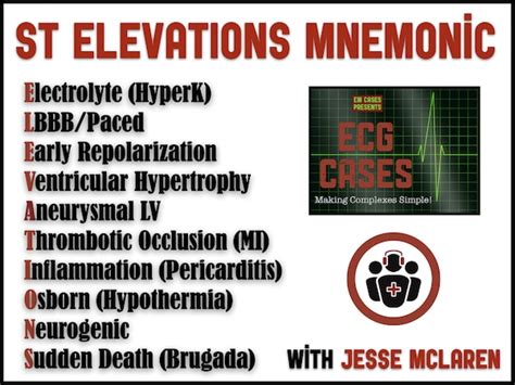 ST ELEVATION Mneumonic and Occlusion MI | ECG Cases | EM Cases