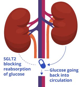 SGLT2 Inhibitors | The Various Types & How They Affect You