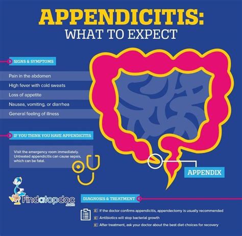 What is Appendicitis? Facts about Appendicitis [Infographic]