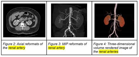 Renal artery stenosis – how do we confirm the diagnosis? – GP Voice