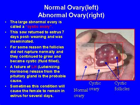 Normal Ovary(left)