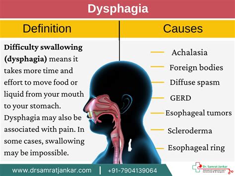 Dysphagia Differential Diagnosis Dysphagia Differenti - vrogue.co