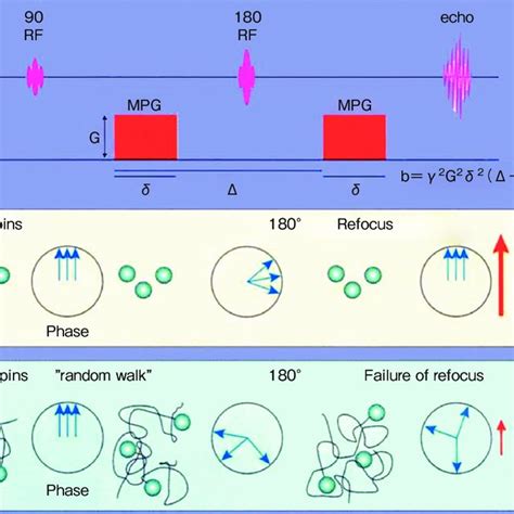 (PDF) Diffusion Magnetic Resonance Imaging: From Isotropic Diffusion-Weighted Imaging to ...