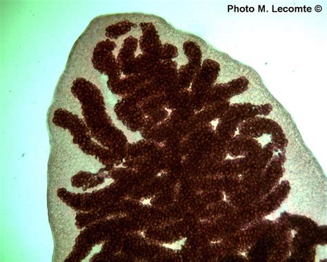 Dicrocoelium dendriticum (M. Lecomte, P. Leroy)