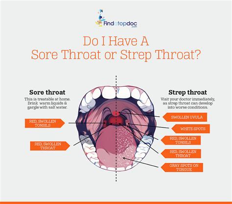 Do I have a Sore Throat or Strep Throat? Photograph by Finda TopDoc ...