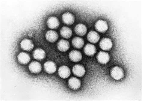 Adenovirus is normally harmless—here's why some outbreaks turn deadly