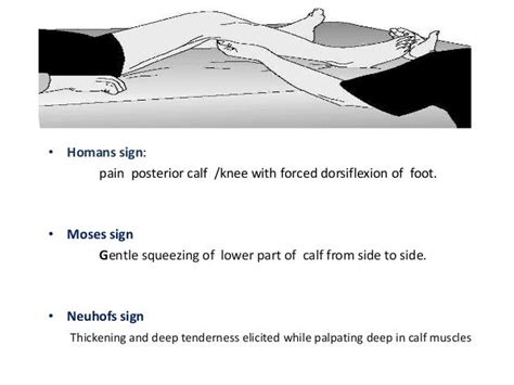 DVT PROPHYLAXIS IN ORTHOPEDIC SURGERIES