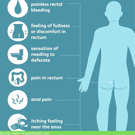 Treating Piles Without Surgery