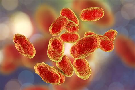 Oral levofloxacin for the treatment of tracheobronchitis in a laryngectomee due to nontypeable ...