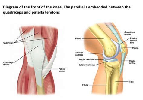 Patella Injury Treatments | Knee Surgeons & Consultants, Yorkshire