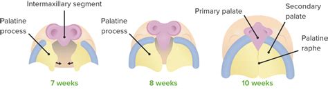 Paladar: Anatomía | Concise Medical Knowledge