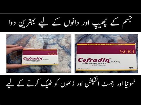 Cefradine Cephradine 500mg Capsule Uses| velosef 500mg benifits| Dosage| in urdu hindi - YouTube