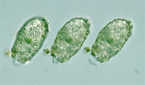 Protist Images: Difflugia pristis