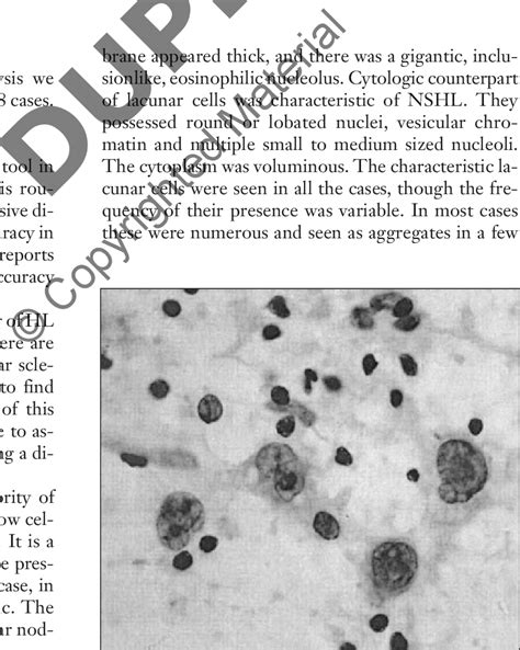 Group of lacunar cells with folded nuclear membrane and single to ...