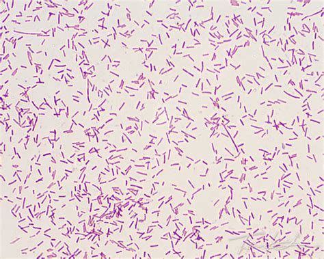 Gram Stain of Escherichia coli | Flickr - Photo Sharing!