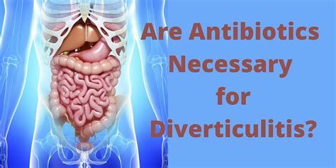 The Functional Medicine Approach to Diverticulitis