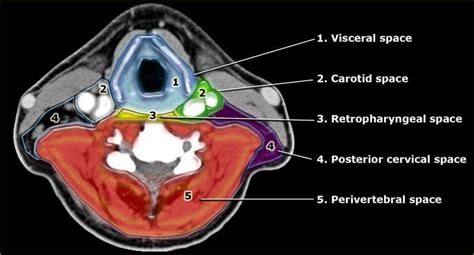 Pin on Head And Neck | Anatomy of the neck, Radiology, Anatomy